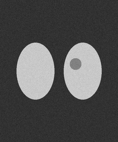 Fundus Photography Example